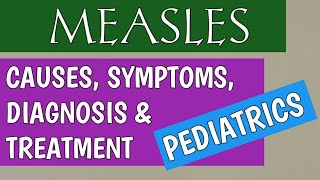 Measles In Children  Subacute Sclerosing Panencephalitis [upl. by Leanora]