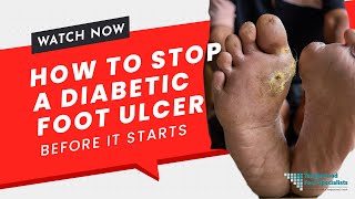 How to Stop a Devastating Diabetic Foot Ulcer Before It Starts [upl. by Richmond]