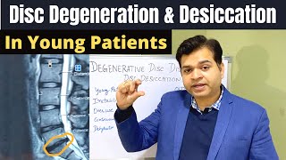 Disc Degeneration L5 S1 Disc Desiccation Disc Degeneration Causes DDDDegenerative Disc Treatment [upl. by Arehc]