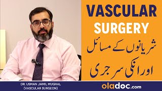 Vascular Disease Treatment  What Is Vascular Surgery amp Types Sharyano Ka Phoolna Ya Phatne Ka Ilaj [upl. by Aivatnuahs]