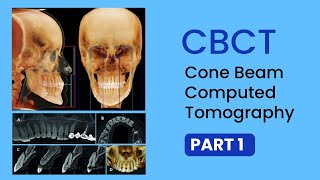 Read CBCT part 1  Basics Uses Interpretations Technical terms of Cone Beam CT Scan [upl. by Ytinirt694]