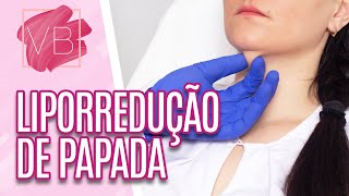 Elimine a papada sem cirurgia  Você vai amar [upl. by Jumbala]