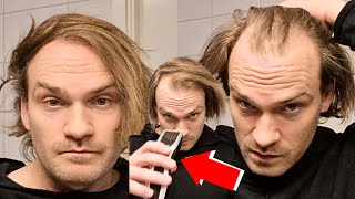 BALDING MAN Transforms His Look By SHAVING HEAD BALD [upl. by Hizar]