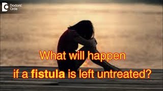 What will happen if a fistula is left untreated  Dr Rajasekhar M R [upl. by Osmen]