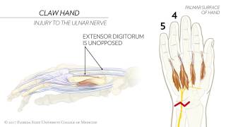 Claw Hand Ape Hand and the Sign of Benediction Animated Review [upl. by Anne-Marie]