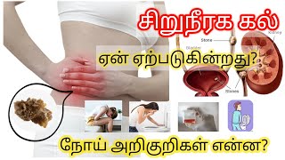 kidney stone symptoms in Tamil  kidney failure symptoms in tamil  kidney stone [upl. by Chryste]