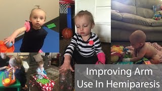 Improving Arm Use In Hemiparesis [upl. by Anrak18]