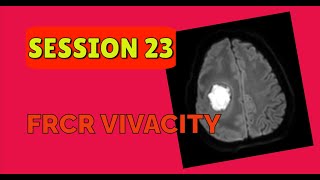 FRCR VIVACITY SESSION 23 [upl. by Ennailuj]