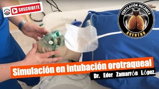 PROCESO DE SECUENCIA DE INTUBACIÓN RÁPIDA [upl. by Hooper]