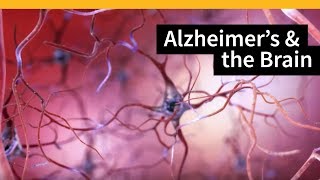 How Alzheimers Changes the Brain [upl. by Cassandra]