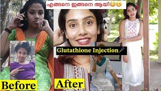 😎5 Years Fairness Cream 🧴Glutathione Injection 🩼എന്റെ മാറ്റത്തിന്റെ കാരണം😳 glamyganga [upl. by Gaskin]