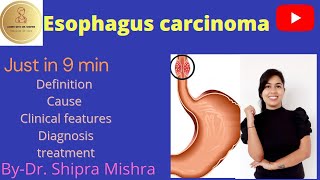 Esophagus Cancer in Hindi Cause Symptoms Diagnosis Treatment Dr Shipra Mishra [upl. by Mallory]