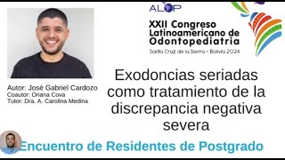 ER116 334 Exodoncias seriadas como tratamiento de la discrepancia negativa severa [upl. by Wilfrid799]