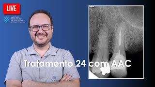 🔴 ProTaper Ultimate  Endodontic Treatment of tooth 24 with CAA [upl. by Paule93]