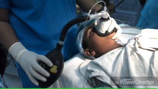 Paediatric anaesthesia [upl. by Krahling]