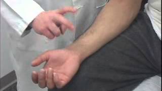 Tinels Test of the Carpal Tunnel [upl. by Acirema]