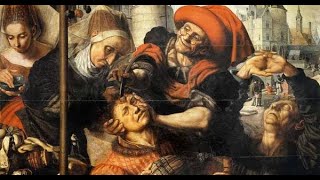 Like a Hole in the Head A History of Trepanning [upl. by Intisar]