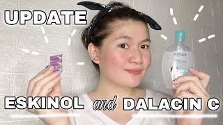 Inexpensive Acne Solution – ESKINOL and DALACIN C UPDATE  EY BELZY [upl. by Ida]