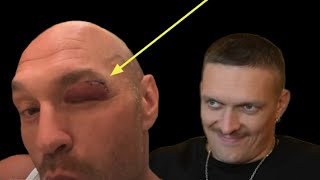 TYSON FURY FINALLY REVEALS HIS INJURED EYE amp TROLLS OLEKSANDR USYK COUNTERPUNCHED [upl. by Lemon]