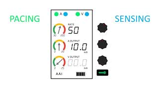 Temporary Epicardial Pacemakers and Sensitivity [upl. by Cl327]