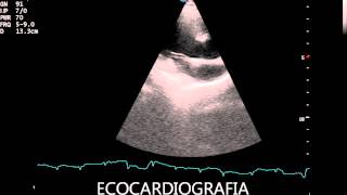 TETRALOGIA FALLOT CANINO [upl. by Hoon]