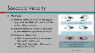 Saccadic Velocity [upl. by Kleeman]