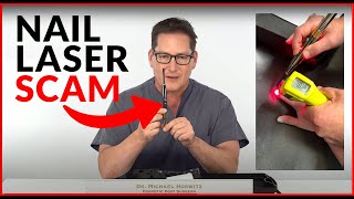 Nail Laser Scams DIY  Home Fungus Toenail Lasers  Do They Really Work [upl. by Ehctav]