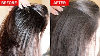 How To Fix Greasy Hair Naturally [upl. by Dranoc935]