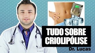 Tudo sobre criolipólise  Dr Lucas Fustinoni [upl. by Bernetta172]