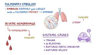 Clinical Reasoning  Syncope  Osmosis [upl. by Atinaej]