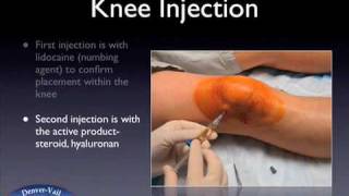 Knee injection web [upl. by Renfred]