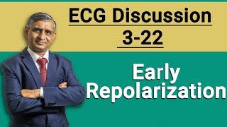 Early Repolarization  ECG Discussion 322  2022 [upl. by Ellicec]