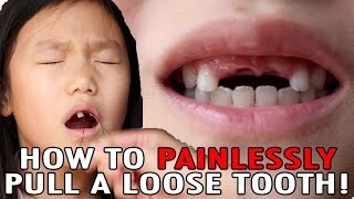 How To Pull A Loose Tooth  No Cry Teeth Pulling Method  Easily Extract Baby Teeth [upl. by Deering502]