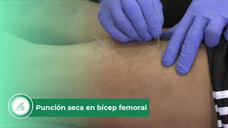 Punción seca en bícep femoral [upl. by Kieger]