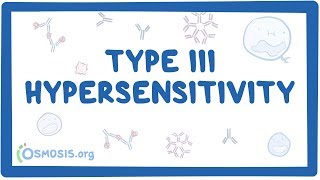 Type III hypersensitivity immune complex mediated  causes symptoms amp pathology [upl. by Eenaj]