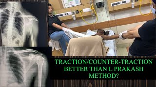 TractionCountertraction better than the L Prakash External rotation method [upl. by Sucramrej288]