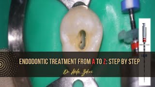 Root canal treatment from A to Z Step by Step [upl. by Bert]