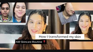 Honest AM skincare Routine 🥰for glass skin acne acnetransformation honestreview honestskincare [upl. by Maddox]