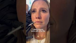 Transform Your Smile With A Lip Flip [upl. by Michaud101]