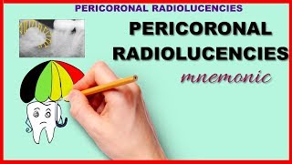 Pericoronal Radiolucency Mnemonic Series 20 [upl. by Nyrrek]