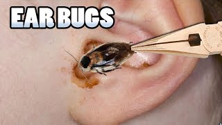 Most Popular Bugs in Ears Bug Removal amp Prevention [upl. by Eioj]