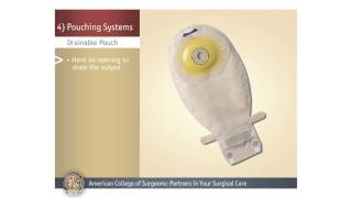 ColostomyIleostomy Pouching Systems [upl. by Corri]