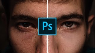 Astuces pour gommer lacné et les boutons de la peau avec Photoshop [upl. by Dominik630]