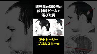 大量の放射線ビームが頭に貫通した男の雑学。怖い話 都市伝説 雑学 [upl. by Anderson]