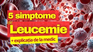 5 simptome explicate LEUCEMIE [upl. by Calandria601]