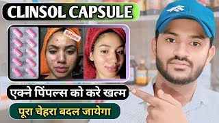 Clinsol capsule uses in hindi how to take clinsol capsule full review in hindi [upl. by Esilana]