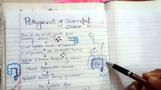 pathogenesis of colorectal cancer NGMedicals [upl. by Gottlieb655]