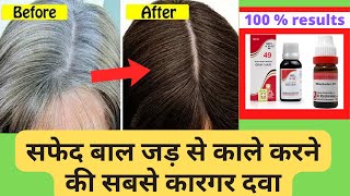 Safed balon ko kala karne ka ilaj Homeopathic medicine for premature grey hairs [upl. by Kawai]