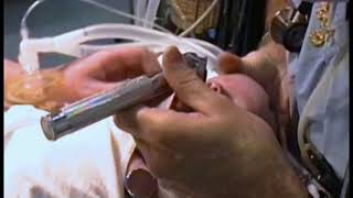 737 Intubation of an Infant [upl. by Anaujnas]