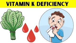 The Surprising Truth About Vitamin K Nobody Tells You [upl. by Jacob]